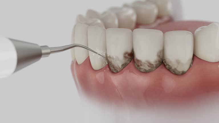 Reliable Teeth Cleaning And Checkup contractor in Anthony, KS by Smile Center Dentistry